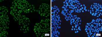 Glucocorticoid Receptor Rabbit mAb Antibody