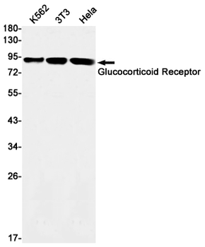 Glucocorticoid Receptor Rabbit mAb Antibody