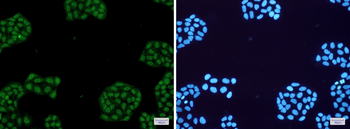 NR1D1 Rabbit mAb Antibody