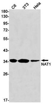 NAT1 Rabbit mAb Antibody