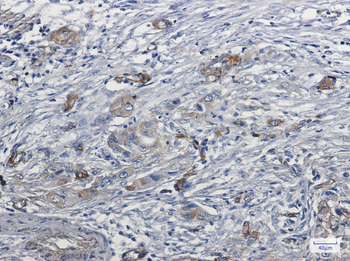 Myosin Ib Rabbit mAb Antibody