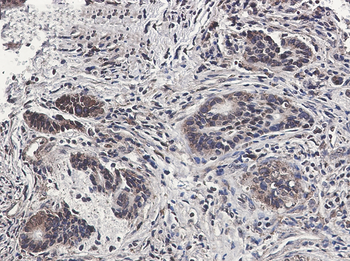 MST1 Rabbit mAb Antibody