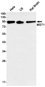 MST1 Rabbit mAb Antibody