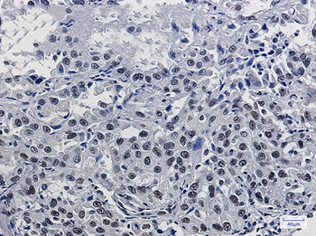 Mre11 Rabbit mAb Antibody