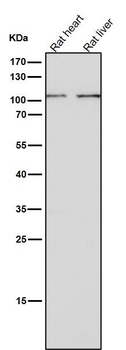 Thrombopoietin Receptor Rabbit mAb