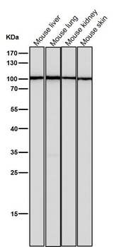 Thrombopoietin Receptor Rabbit mAb