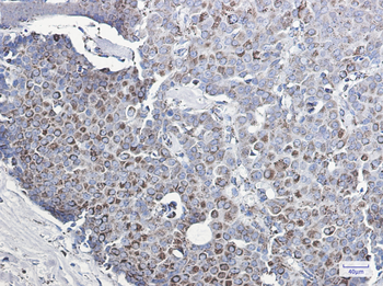 MMP3 Rabbit mAb Antibody