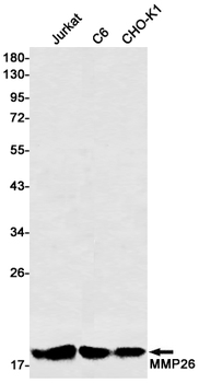 MMP26 Rabbit mAb Antibody