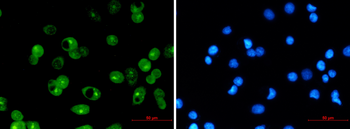 MCL1 Rabbit mAb Antibody