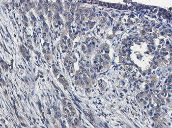 MAP3K4 Rabbit mAb Antibody