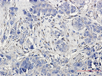 LRP1 Rabbit mAb
