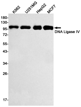DNA Ligase IV Rabbit mAb Antibody