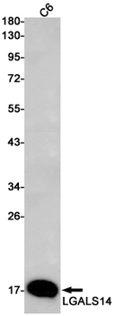 LGALS14 Rabbit mAb Antibody
