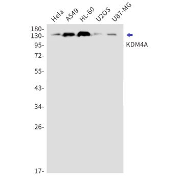 KDM4A Rabbit mAb Antibody