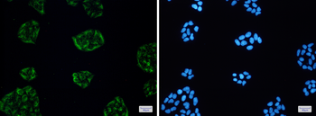 KCTD9 Rabbit mAb Antibody