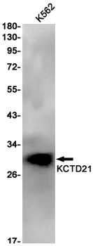 KCTD21 Rabbit mAb Antibody
