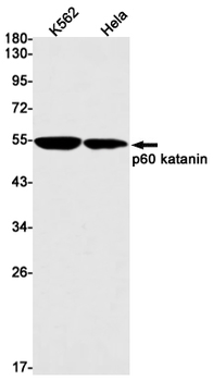 p60 Katanin Rabbit mAb Antibody
