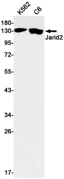 Protein Jumonji Rabbit Monoclonal Antibody