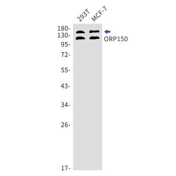 ORP150 Rabbit mAb Antibody