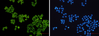 Glycogen Synthase 1 Rabbit mAb Antibody