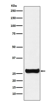 Glutathione S Transferase mu 1 Rabbit Monoclonal Antibody