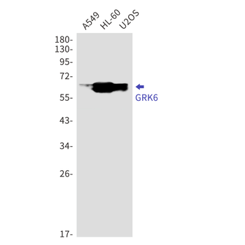 GRK6 Rabbit mAb Antibody