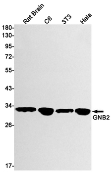 GNB2 Rabbit mAb Antibody