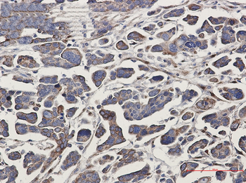 GNA13 Rabbit mAb Antibody