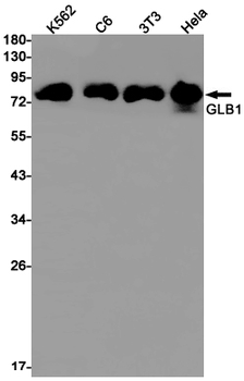 GLB1 Rabbit mAb Antibody