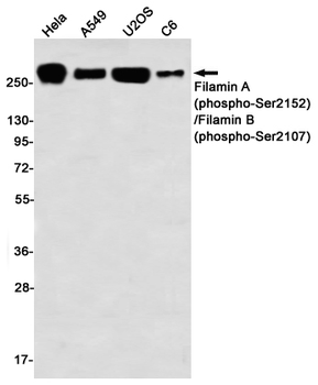 Phospho-Filamin A/B (Ser2152/Ser2107) Rabbit mAb