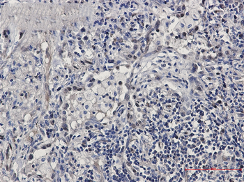 FDPS Rabbit mAb Antibody