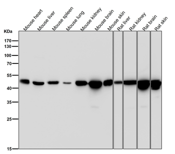 Tissue Factor Rabbit mAb
