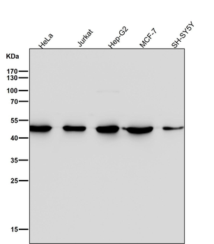 Tissue Factor Rabbit mAb