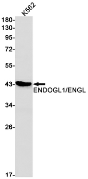 ENDOGL1 Rabbit mAb Antibody