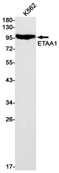 ETAA1 Rabbit mAb Antibody