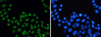 XPD Rabbit mAb Antibody