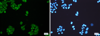 ELOVL5 Rabbit mAb Antibody