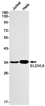 ELOVL5 Rabbit mAb