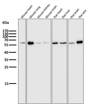 E2F1 Rabbit mAb