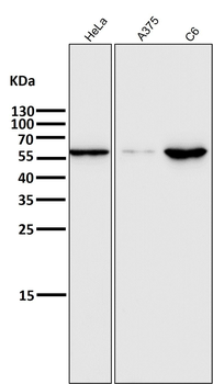 E2F1 Rabbit mAb