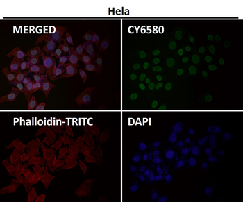 E2F1 Rabbit mAb