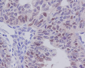 E2F1 Rabbit mAb