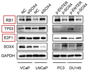 E2F1 Rabbit mAb