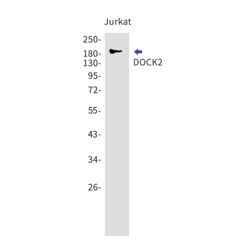 DOCK2 Rabbit mAb Antibody