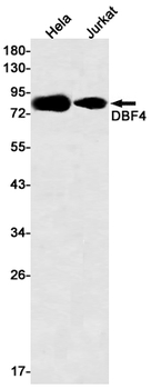 DBF4 Rabbit mAb Antibody