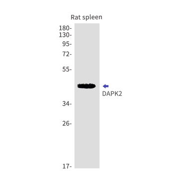 DAPK2 Rabbit mAb Antibody