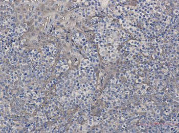 Cystatin B Rabbit mAb Antibody