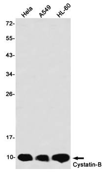 Cystatin B Rabbit mAb Antibody
