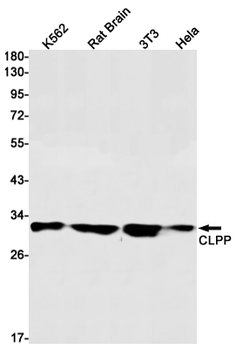 CLPP Rabbit mAb Antibody