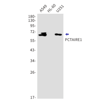 CDK16 Rabbit Monoclonal Antibody